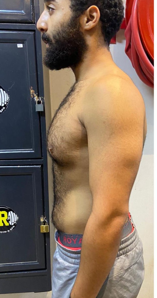 transformation